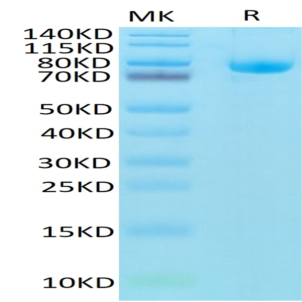 Biotinylated Human CD5 Protein (CD5-HM501B)