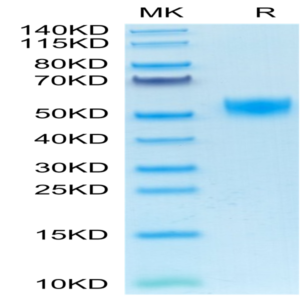 Mouse CD5 Protein (CD5-MM101)