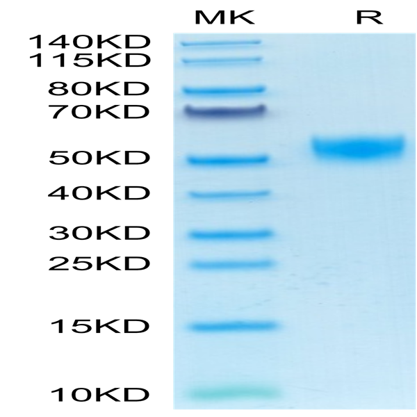 Mouse CD5 Protein (CD5-MM101)
