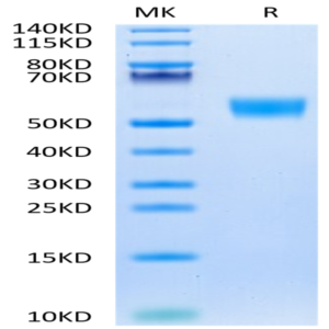 Biotinylated Mouse CD5 Protein (Primary Amine Labeling) (CD5-MM101B)