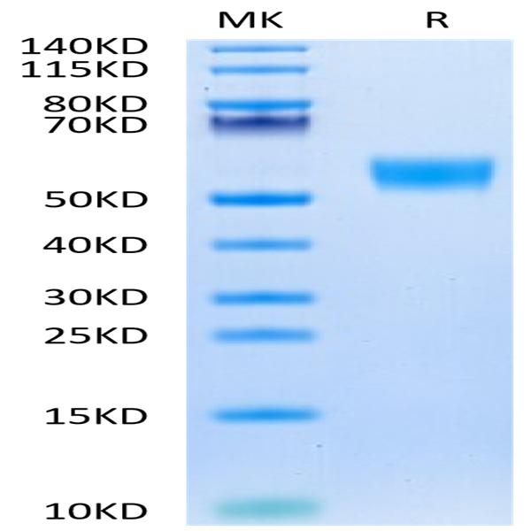 Biotinylated Mouse CD5 Protein (Primary Amine Labeling) (CD5-MM101B)