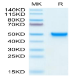 Mouse CD5L Protein (CD5-MM10L)