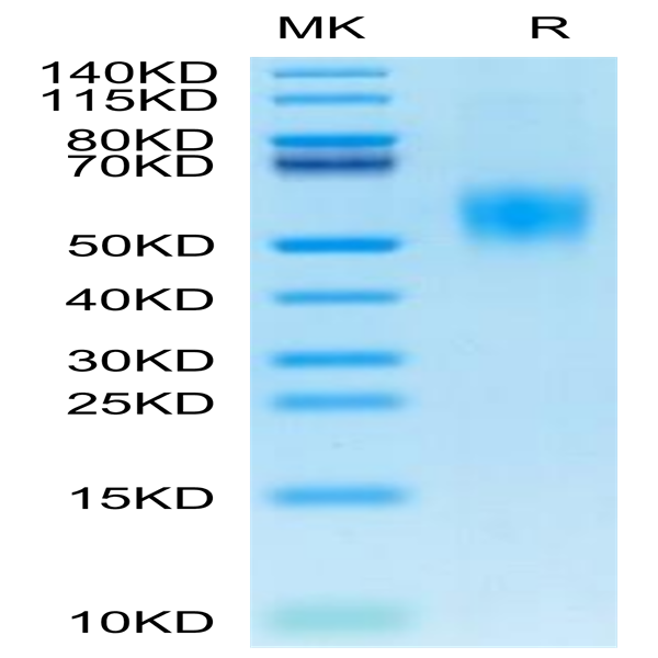 Mouse IL-2 R alpha/CD25 Protein (CD5-MM125)