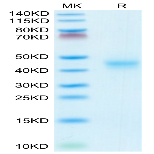 Mouse CD52 Protein (CD5-MM252)