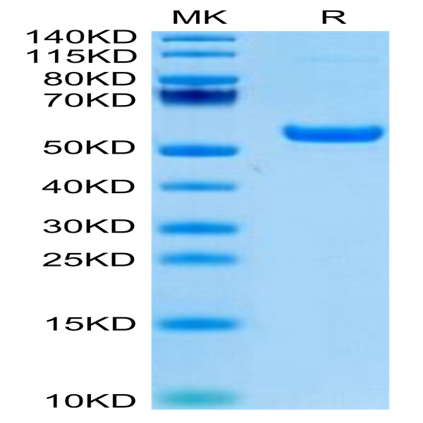 Rhesus macaque CD5 Protein (CD5-RM405)