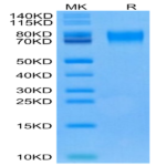 Human CD6 Protein (CD6-HM101)