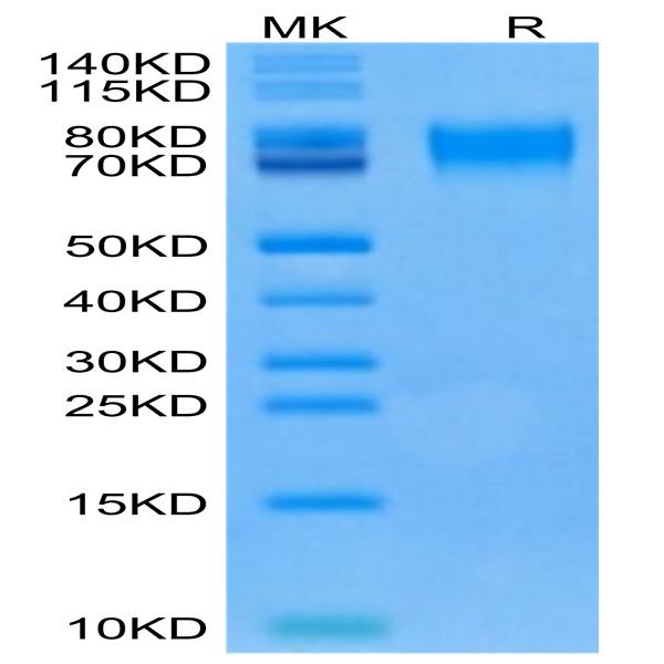Human CD6 Protein (CD6-HM101)
