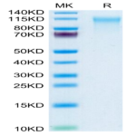 Human CD164 Protein (CD6-HM204)