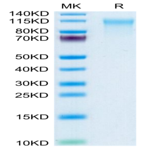 Human CD164 Protein (CD6-HM204)