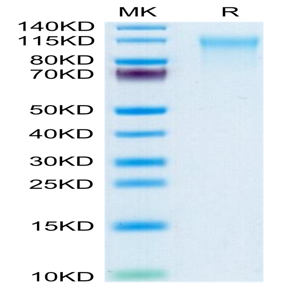 Human CD164 Protein (CD6-HM204)