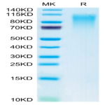 Mouse CD164 Protein (CD6-MM204)