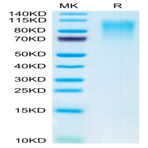 Mouse CD164 Protein (CD6-MM204)