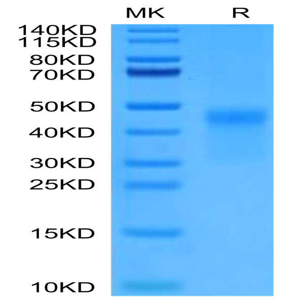 Cynomolgus CD7 Protein (CD7-CM101)
