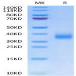 Human CD72 Protein (CD7-HM172)