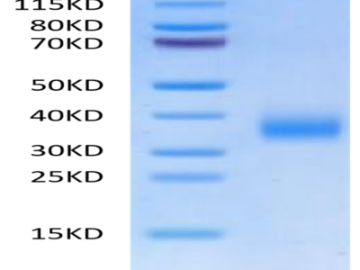 Human CD72 Protein (CD7-HM172)