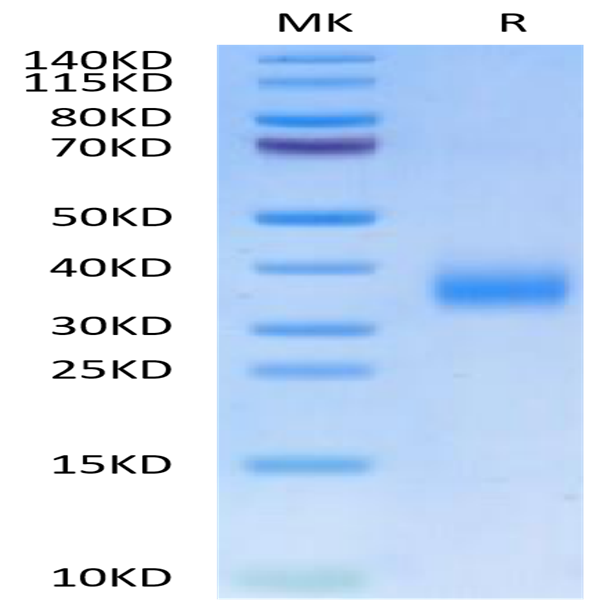 Human CD72 Protein (CD7-HM172) Human CD72 Protein (CD7-HM172)