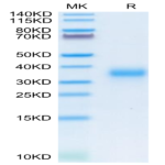 Human CD74/DHLAG Protein (CD7-HM175)