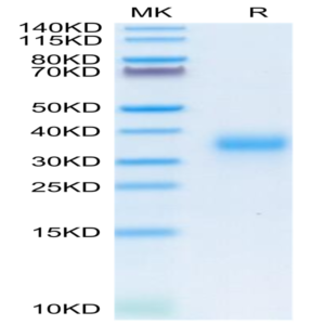Human CD74/DHLAG Protein (CD7-HM175)