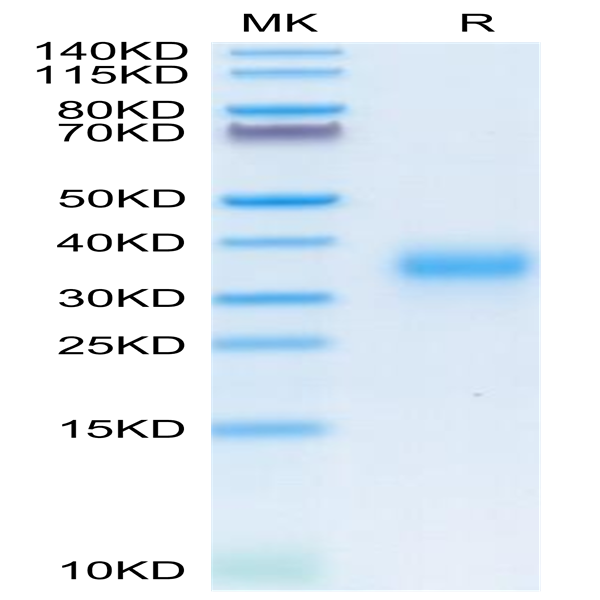 Human CD74/DHLAG Protein (CD7-HM175)