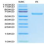 Human CD7 Protein (CD7-HM201)