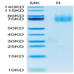 Human CD27 Ligand/CD70 Protein (CD7-HM270)