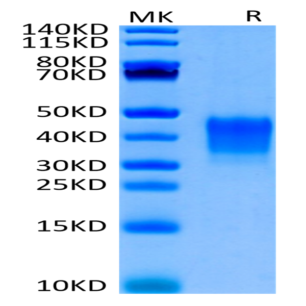 Biotinylated Human CD7 Protein (CD7-HM401B)