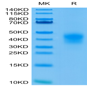 Human CD79B Protein (CD7-HM49B)