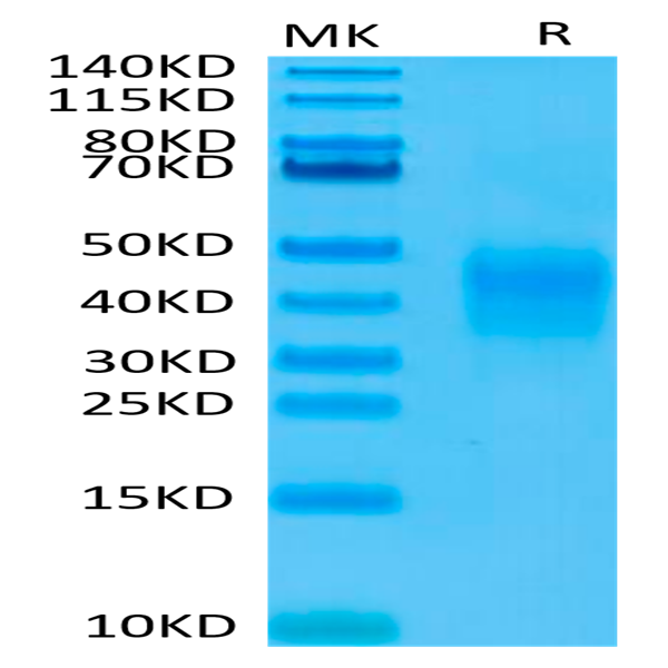 Biotinylated Human CD79B Protein (CD7-HM49BB)