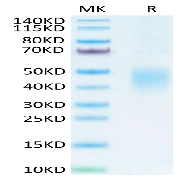 Mouse CD74/DHLAG Protein (CD7-MM175)