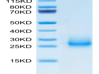 Mouse CD7 Protein (CD7-MM201)