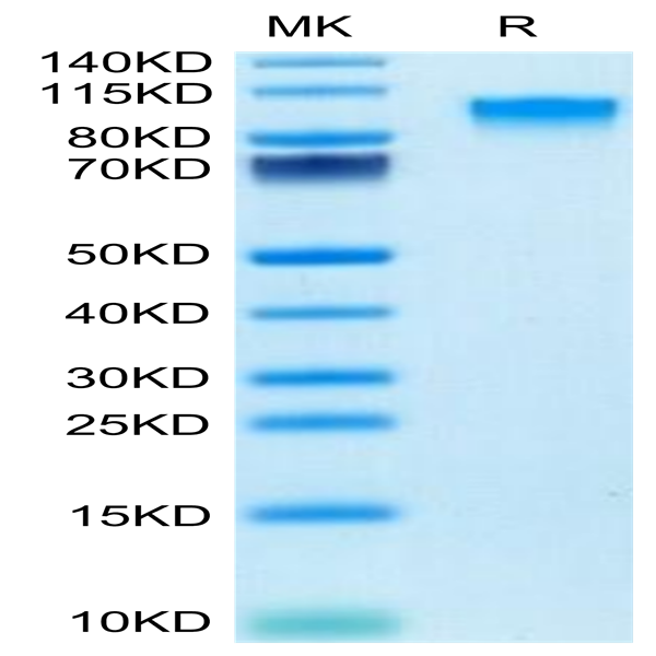 Mouse IL-17R alpha/CD217 Protein (CD7-MM2RA)