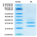 Human CD83 Protein (CD8-HM183)