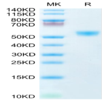 Human CD28H/IGPR-1 Protein (CD8-HM28H)