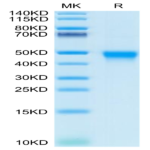 Human CD84/SLAMF5 Protein (CD8-HM484)