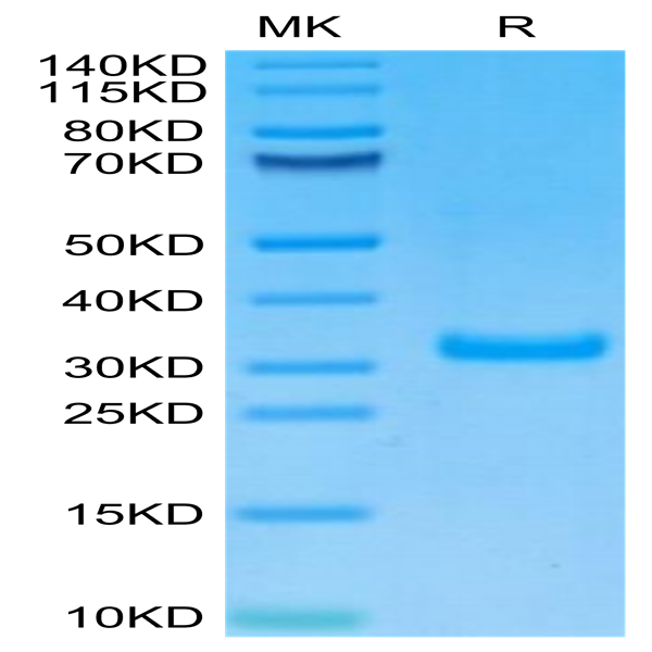 Biotinylated Human CD8 alpha/CD8A Protein (CD8-HM48AB)