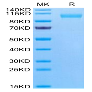 Human CD9P1 Protein (CD9-HM101)