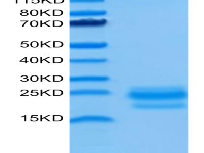 Human CD99/MIC2 Protein (CD9-HM199)