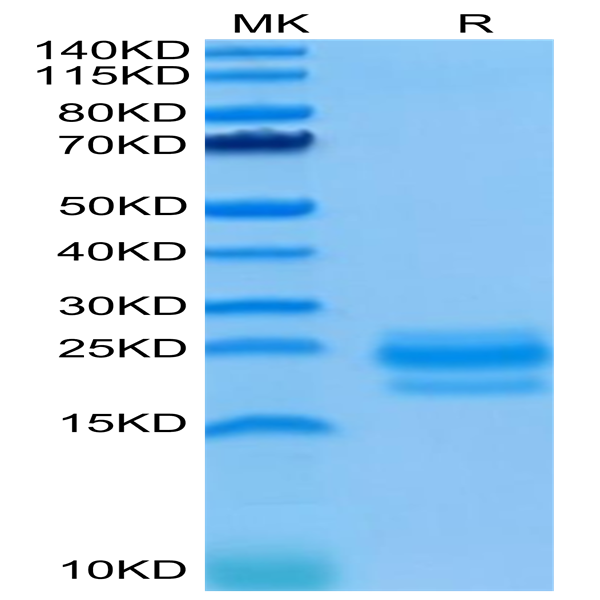 Human CD99/MIC2 Protein (CD9-HM199) Human CD99/MIC2 Protein (CD9-HM199)
