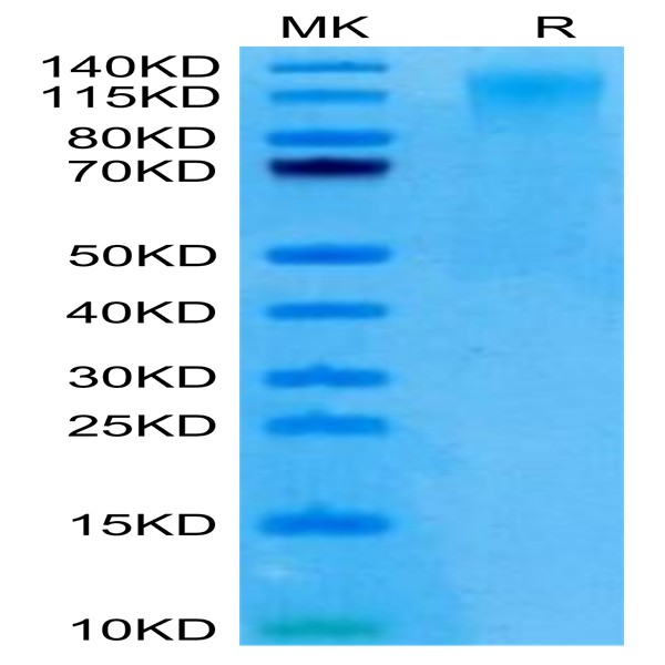 Human CD96/TACTILE (C110S) Protein (CD9-HM19S)