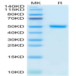 Human CD99/MIC2 Protein (CD9-HM299)