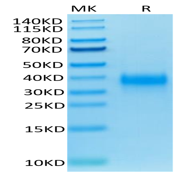 Biotinylated Human CD94 Protein (CD9-HM404B)