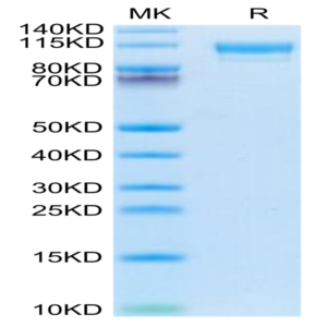 Mouse CD9P1 Protein (CD9-MM101)