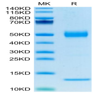 Human CD1A Protein (CDA-HM11A)