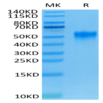 Human Fc gamma RIIIA/CD16a (F176) Protein (CDA-HM416)
