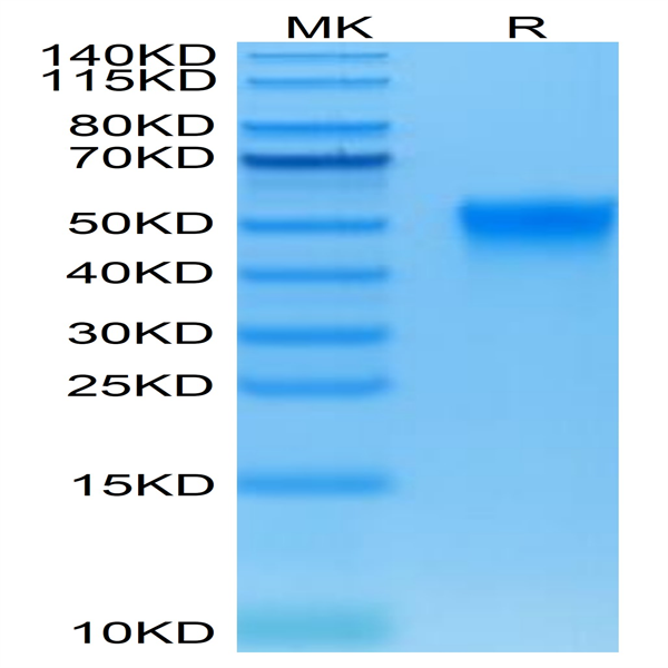 Biotinylated Human Fc gamma RIIIA/CD16a (F176) Protein (CDA-HM416B)