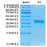 Human Fc gamma RIIA/CD32a (H167) Protein (CDA-HM432)