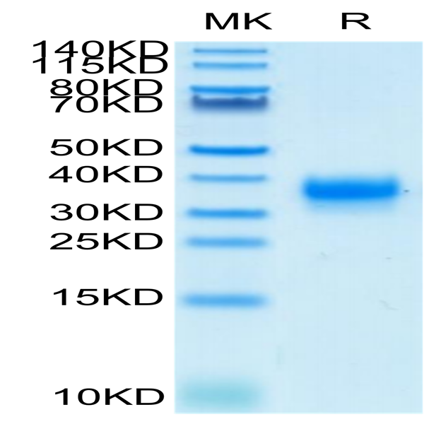 Biotinylated Human Fc gamma RIIA/CD32a (H167) Protein (CDA-HM432B)
