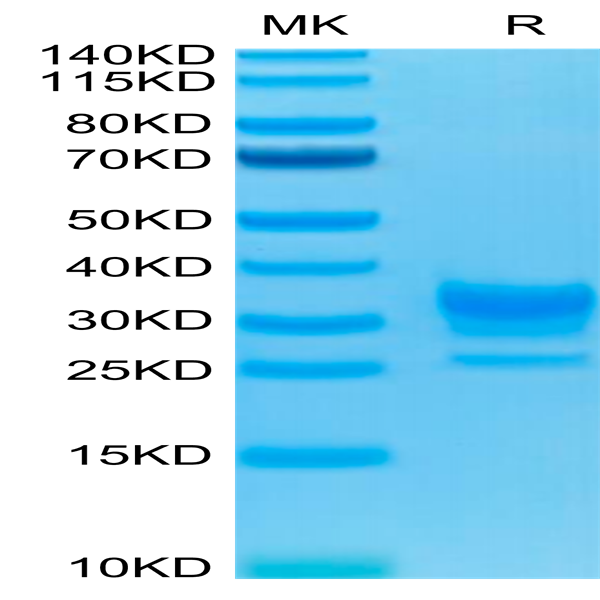 Biotinylated Human Fc gamma RIIB/CD32b Protein (CDB-HM401B)