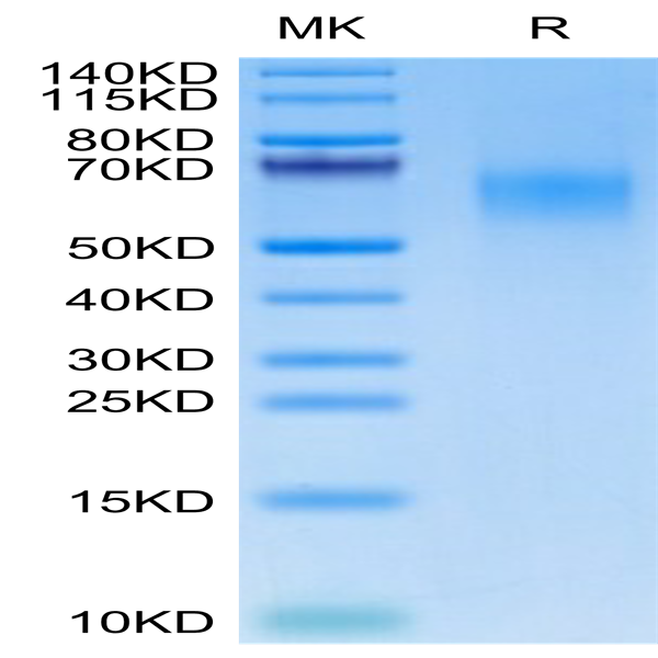 Human CDCP1 (30-368) Protein (CDC-HM10D)
