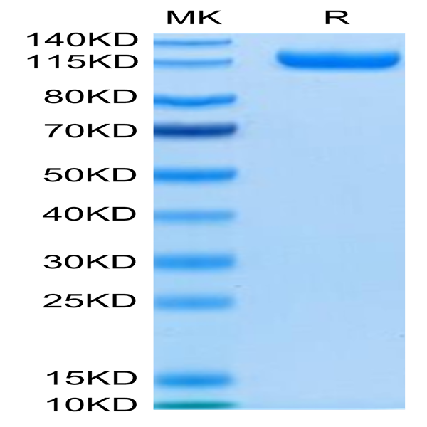 Human CDCP1 Protein (CDC-HM201)